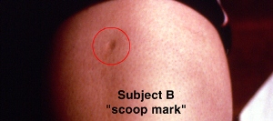 Scoop mark
